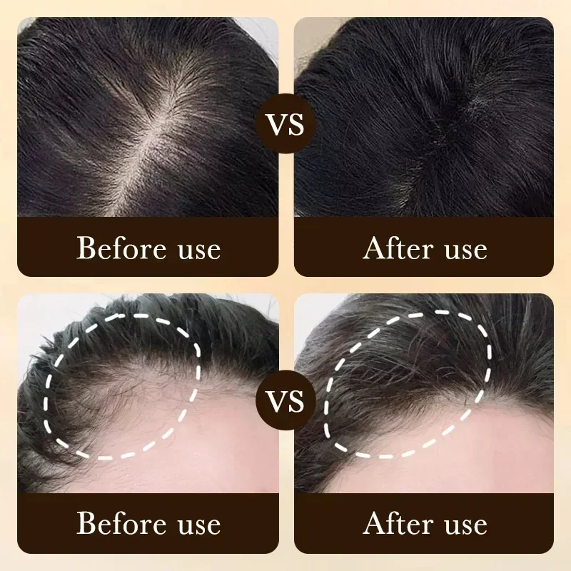 Biotin fast Hair Growth oil Products Care Scalp Massage Treatments Anti Hair Loss Effective Grow Thicker Hair serum for men - Image 2