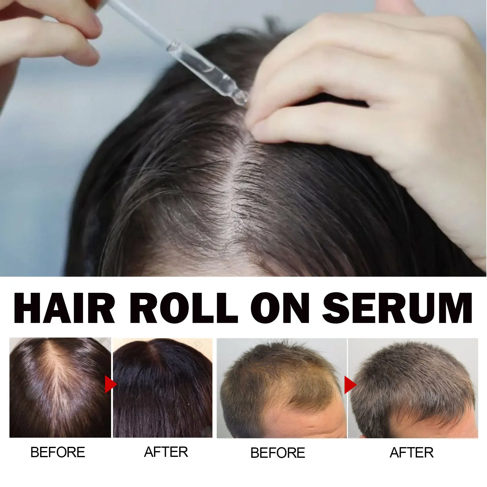 Eelhoe Jojoba Oil Hair Growth Serum Reduce Loss Scalp Treatment More Thicker Keep Regrowth Oil Control Hair Nourish Essencial Oi - Image 3