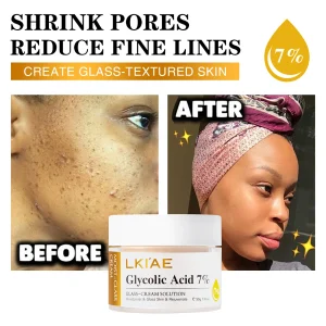 LKIAE Brightening Face Cream, Moisturizing, Reduce Black Spots, Hyperpigmentation, Wrinkles, Fine Lines, With Hyaluronic Acid